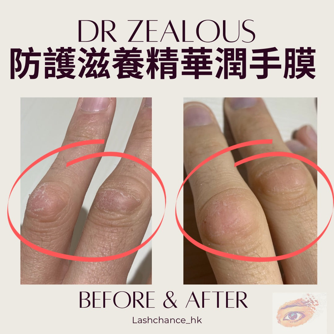 Dr. Zealous Protective Nourishing Essence Hand Mask 10 Pairs