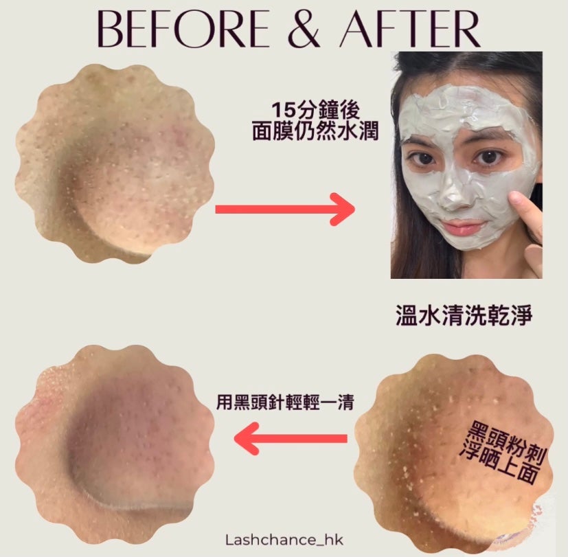 Bio~C~Ziwi French Shihua Volcanic Mud and Bean Acne Mask